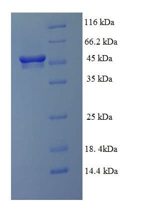 Rhodobacter sphaeroides Modification methylase RsrI Protein (Recombinant His-SUMO)