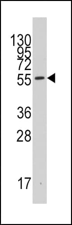 Polyclonal Rabbit anti-Human IDO1 / IDO Antibody (aa374-403, IHC, WB)
