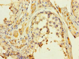 KDM8 / JMJD5 / FLJ13798 Antibody