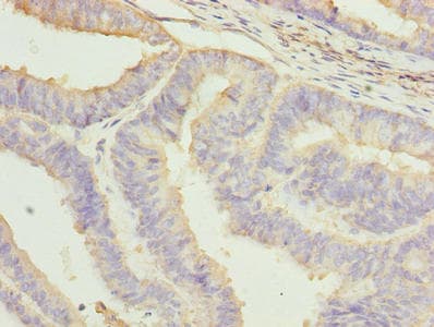 NRARP Antibody