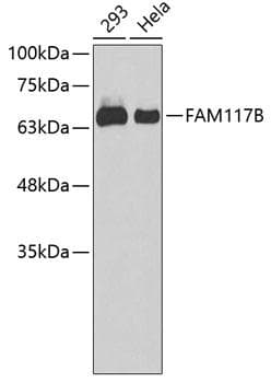 FAM117B / ALS2CR13 Antibody