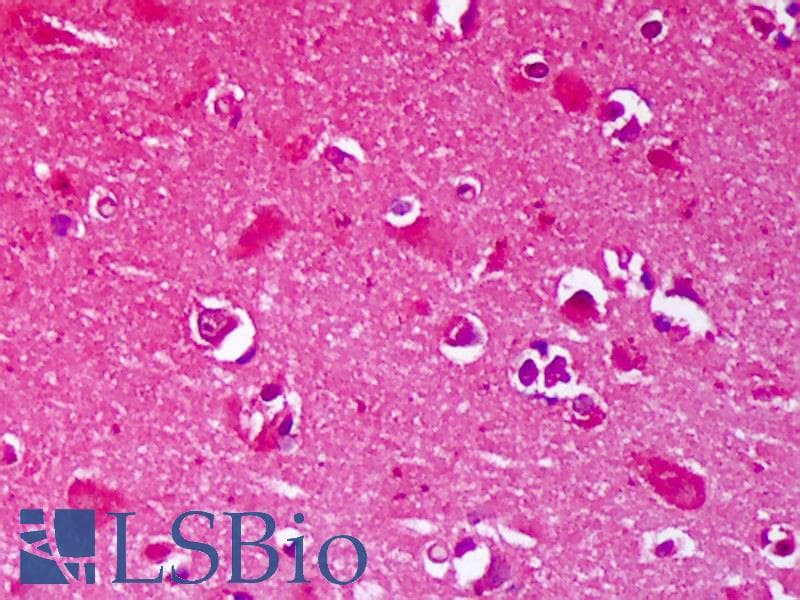 IHC-plus™ GRIN2B / NMDAR2B / NR2B Antibody (aa20-271, clone S59-36)
