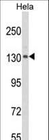 CLIP1 / CLIP-170 Antibody (aa228-254)