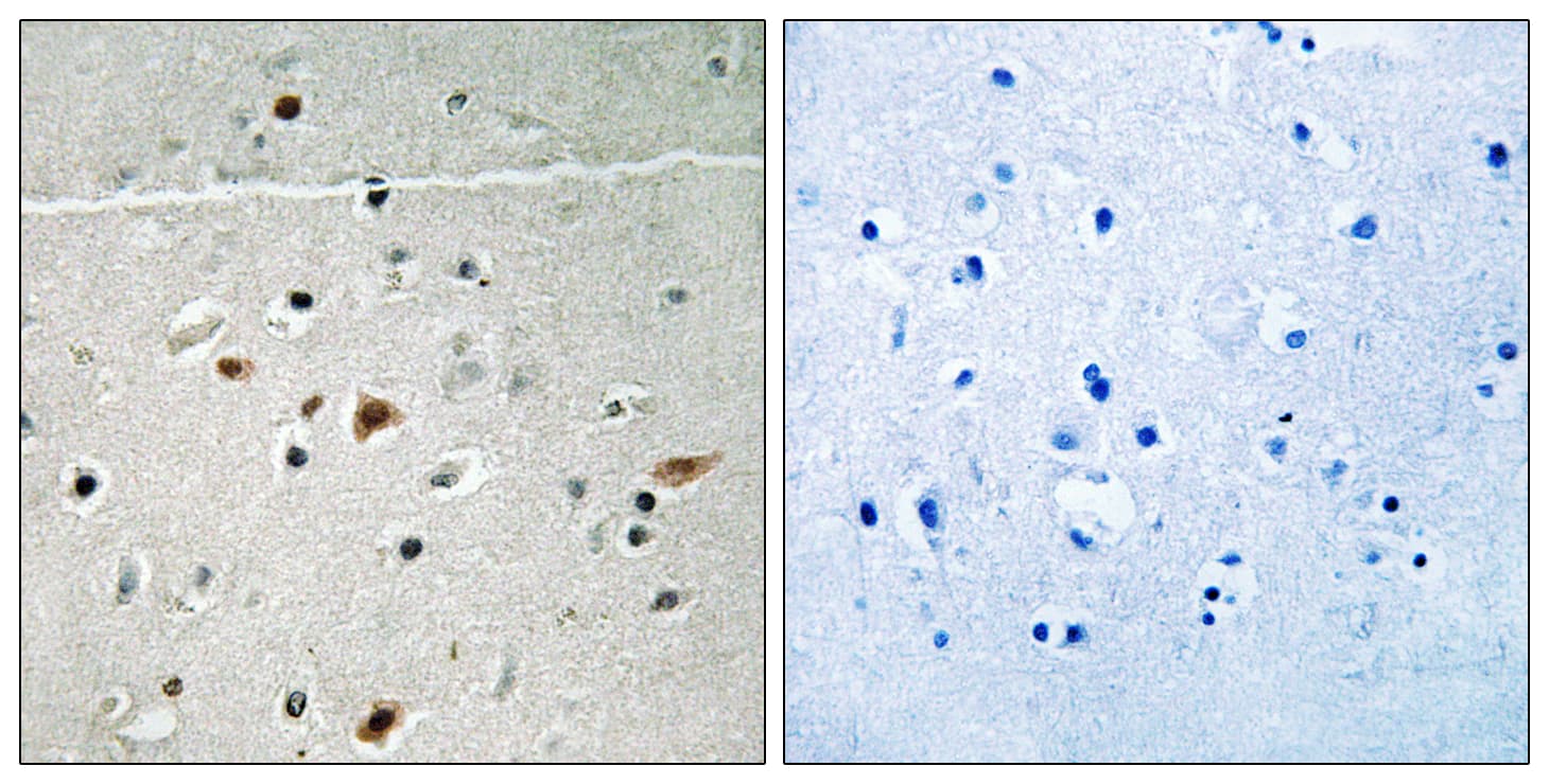 LIMK2 Antibody (phospho-Ser283)