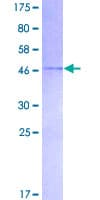 Human NBL1 / DAN Protein (Recombinant GST)