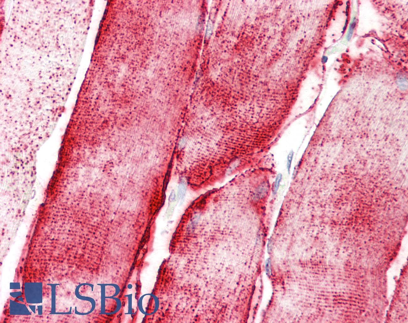 IHC-plus™ STOX1 Antibody