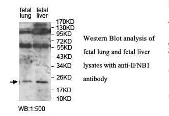 IFN Beta / Interferon Beta Antibody (aa23-187)