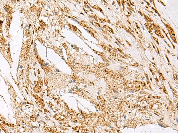 DNPEP Antibody