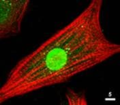 IHC-plus™ AKT1 + AKT2 + AKT3 Antibody (aa460-480)