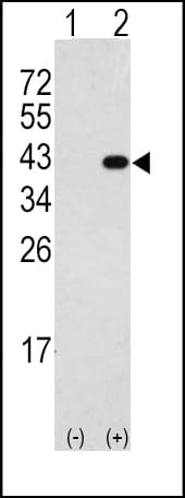 DAPK2 / DAP Kinase 2 Antibody (aa40-70)