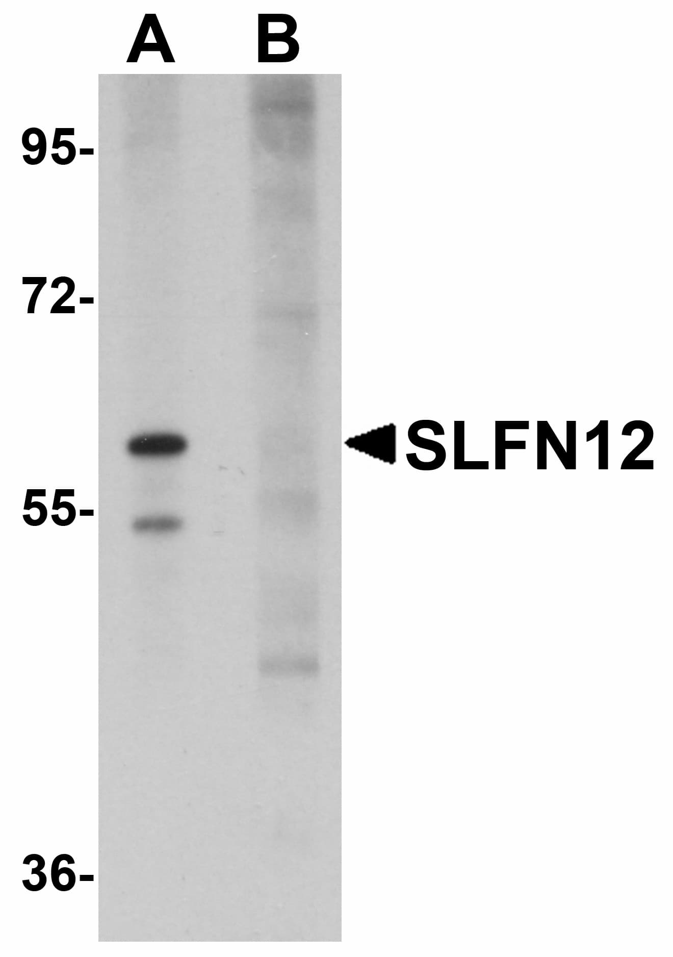 IHC-plus™ Polyclonal Rabbit anti-Human SLFN12 Antibody (IHC, WB)