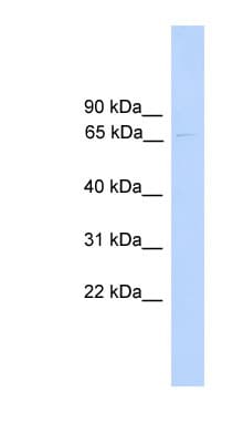 PARP6 Antibody (N-Terminus)