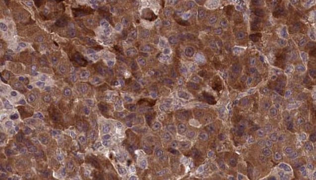APLP1 / APLP-1 Antibody
