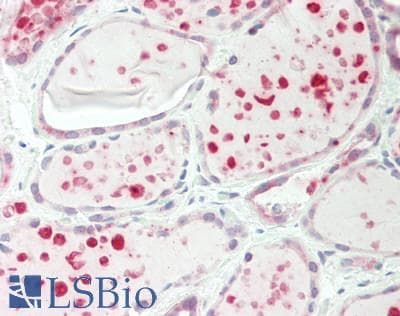 IRS Antibody (C-Terminus)