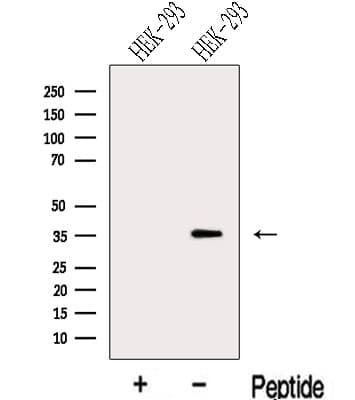 LZTFL1 Antibody