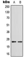 5-Alpha Reductase / SRD5A1 Antibody (C-Terminus)