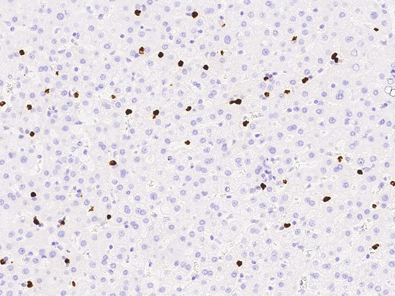 MMP9 / Gelatinase B Antibody (Preservative Free)