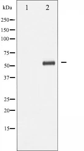 PDCD4 Antibody (phospho-Ser67)