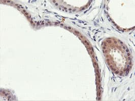 Monoclonal Mouse anti-Human PNPO Antibody (clone OTI1H9, IHC, WB)