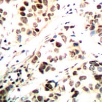 CHEK1 / CHK1 Antibody (phospho-Ser296)
