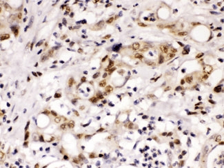 CCNT1 / Cyclin T1 Antibody