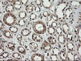Monoclonal Mouse anti-Human PIK3CG / PI3K Gamma Antibody (clone OTI2B1, IHC, WB)