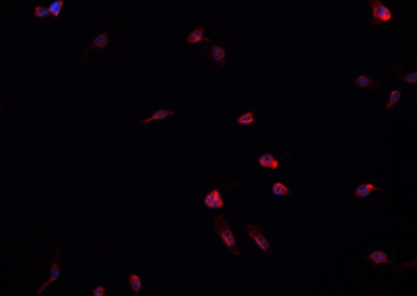 MAPK8 / JNK1 Antibody (phospho-Thr183,pTyr185)