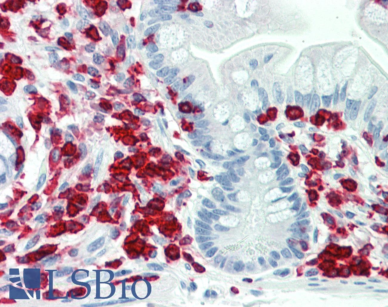 IHC-plus™ Polyclonal Rabbit anti-Human PON2 Antibody (aa79-107, IHC, WB)