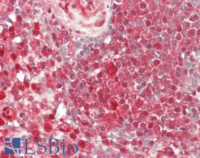 IHC-plus™ Heat Shock Protein 70 / HSPA1A Antibody (aa574-600, clone 201CT8.2.3)