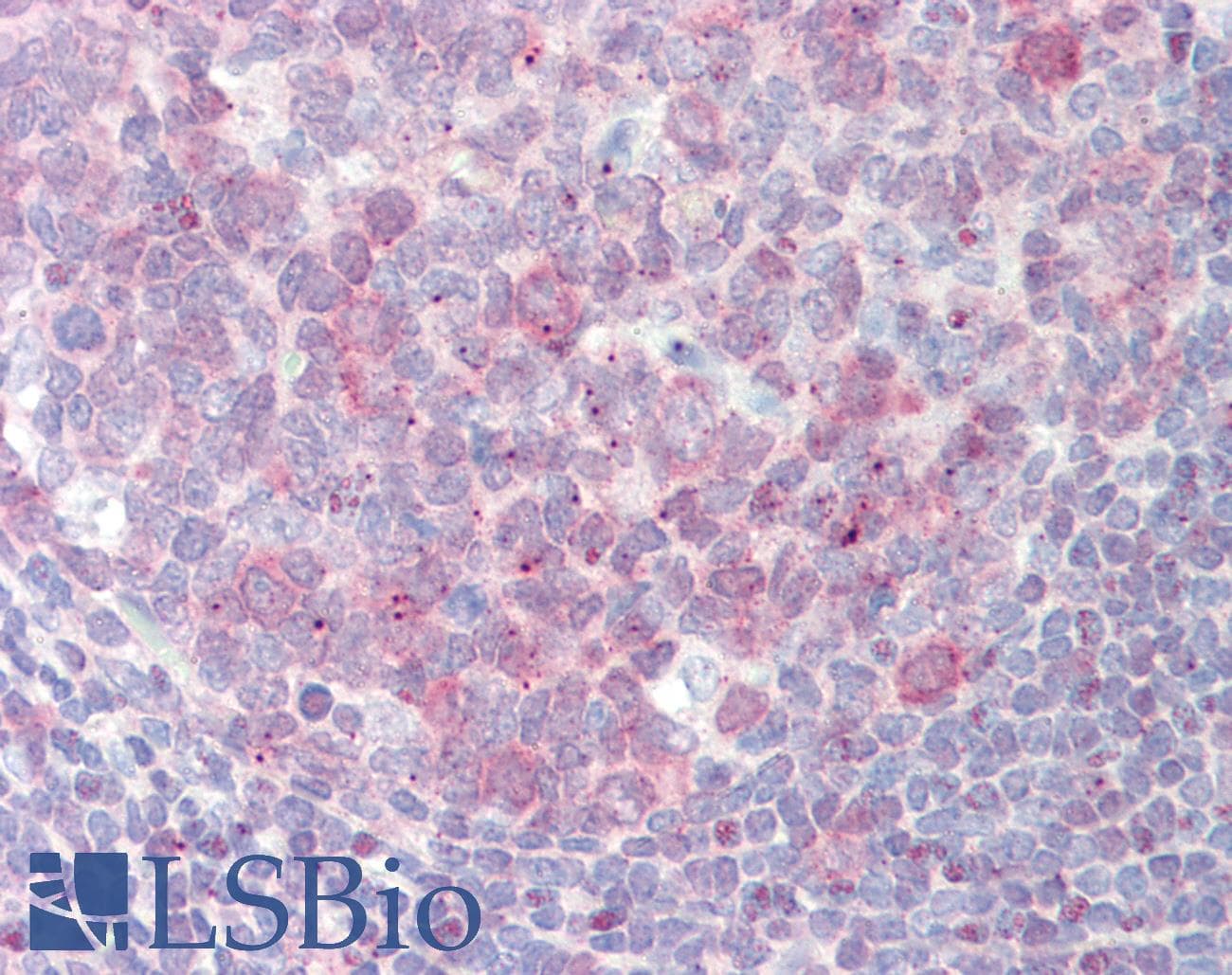 Polyclonal Rabbit anti-Human PFAS Antibody (aa252-301, IHC, WB)