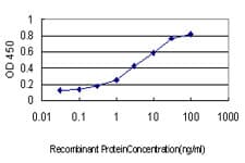 IHC-plus™ BIK Antibody (clone 4G12)