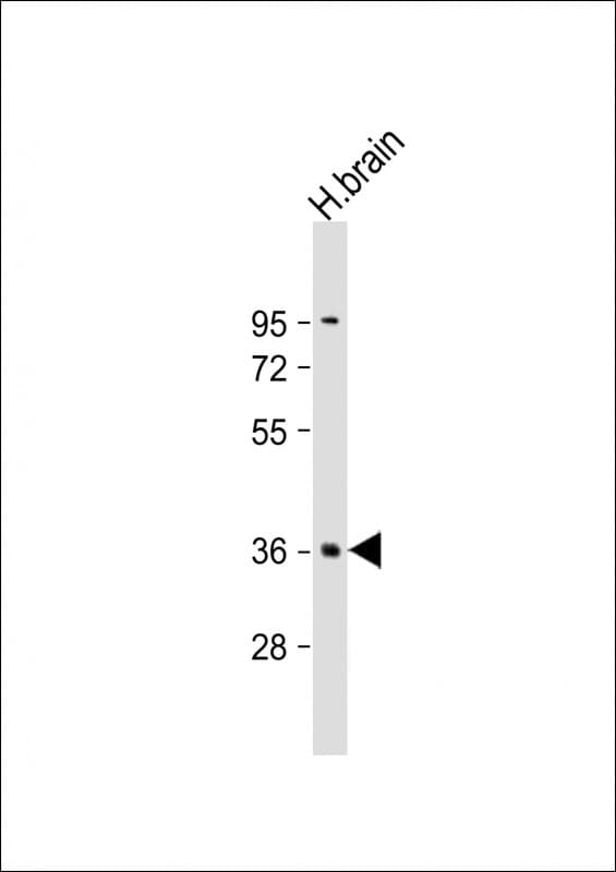 Polyclonal Rabbit anti-Human PLK5 Antibody (aa140-174, WB)
