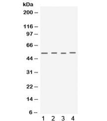 KERA / Keratocan Antibody