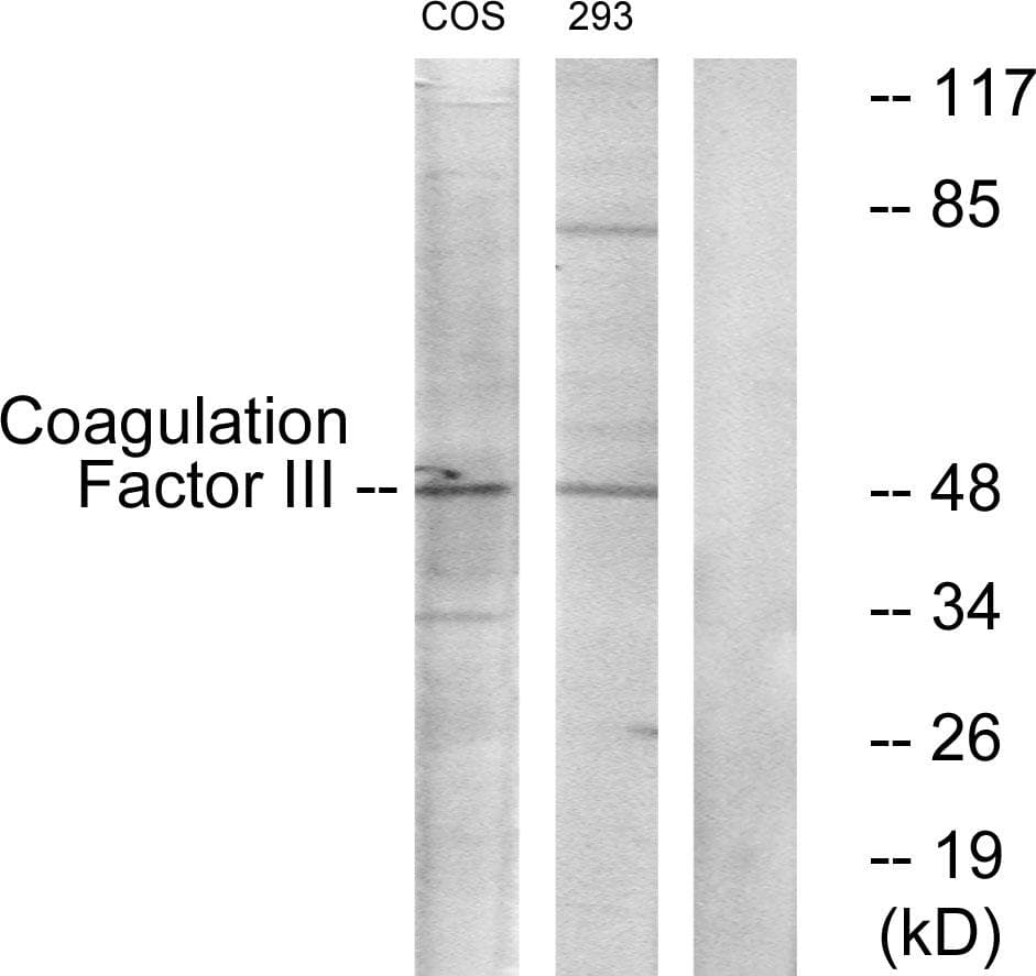 F3 / CD142 / Tissue factor Antibody (p290)