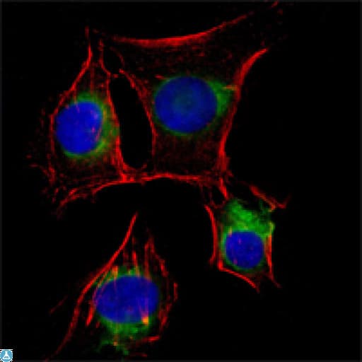 NGFR / CD271 / TNR16 Antibody