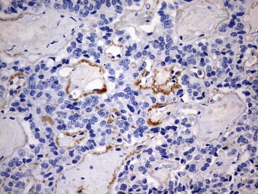 RIPK3 / RIP3 Antibody (aa233-518, clone OTI1B3)