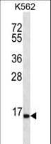 SPINK8 Antibody (aa63-91)