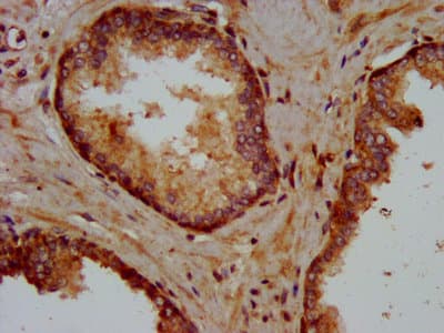 Polyclonal Rabbit anti-Human KIFAP3 / KAP3 Antibody (IF)