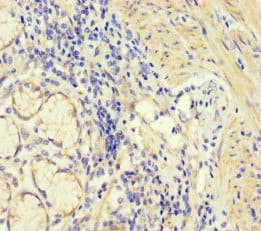 CORO1B Antibody