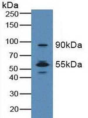 MST1R / RON Antibody (aa1092-1316)