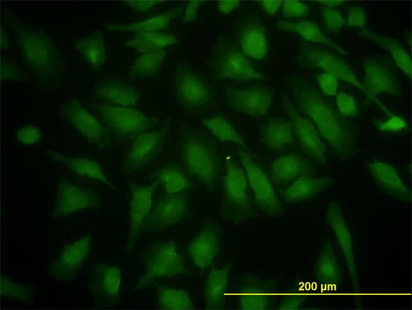 PIK3R4 Antibody (clone 1B5)