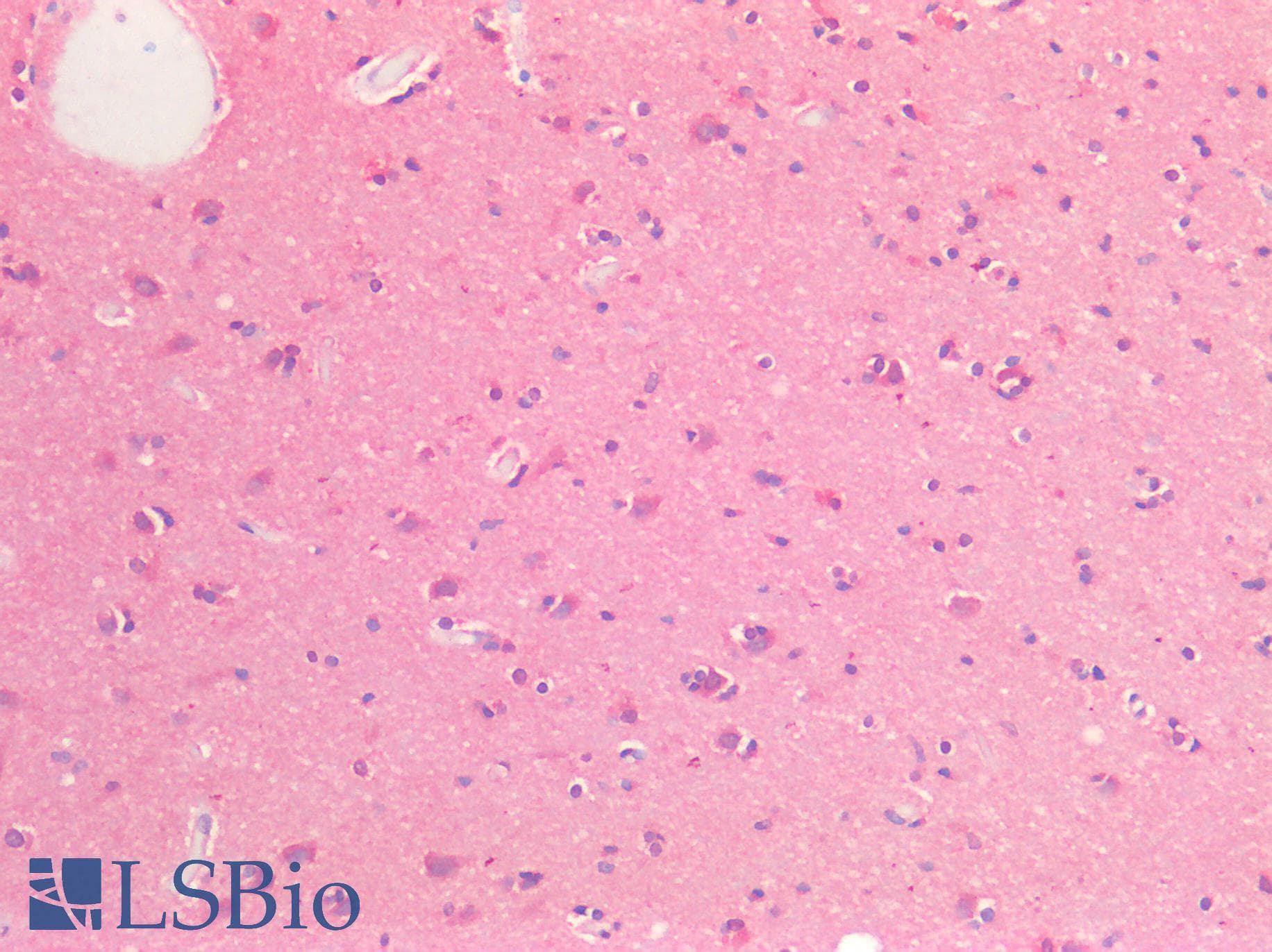 IHC-plus™ EPHB2 / EPH Receptor B2 Antibody (C-Terminus)
