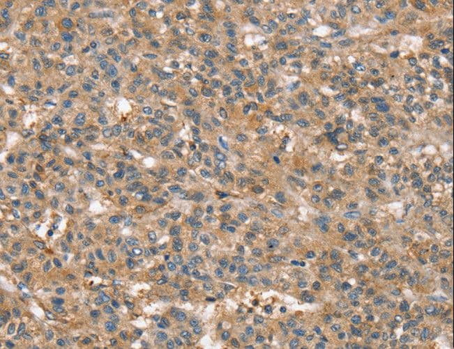 Polyclonal Rabbit anti-Human SSX2IP Antibody (IHC, WB)