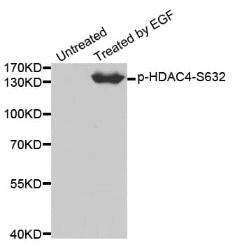 HDAC4 Antibody (phospho-Ser632)