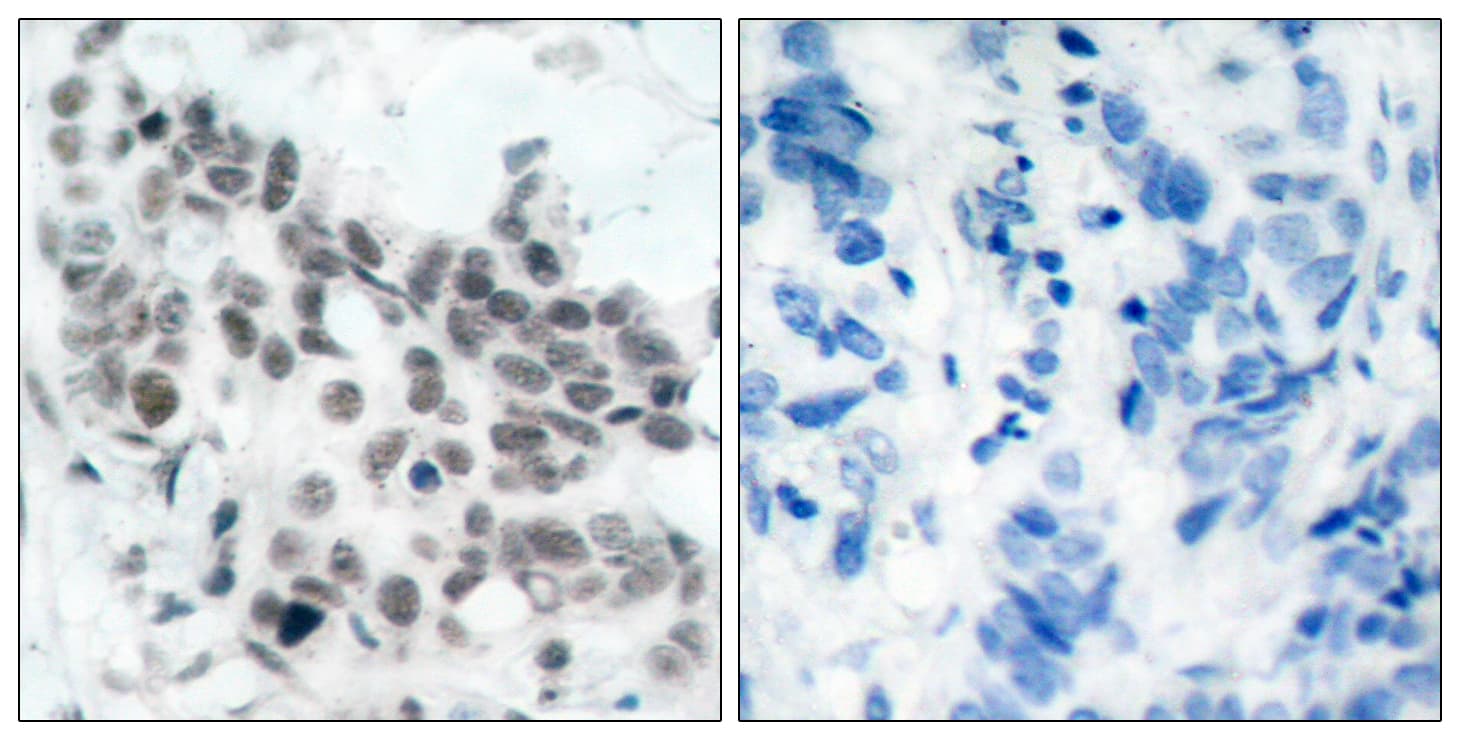 Polyclonal Rabbit anti-Human RB1 / Retinoblastoma / RB Antibody (phospho-Ser780, IHC, WB)