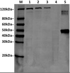Streptococcus pyogenes CRISPR-associated endonuclease Cas9/Csn1 Antibody (clone 11C12)