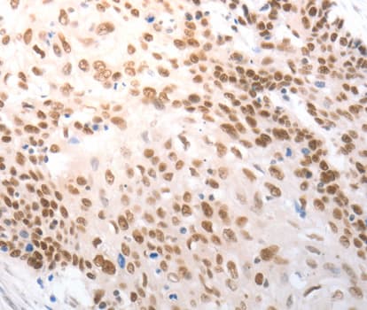 Polyclonal Rabbit anti-Human SLC22A8 / OAT3 Antibody (IHC, WB)