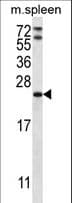 RAP1A Antibody (aa142-170)