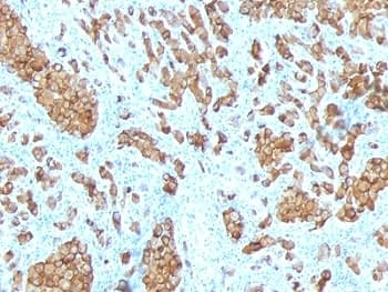 MLANA / Melan-A Antibody (clone SPM342)