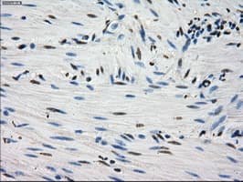 Monoclonal Mouse anti-Human FH / Fumarase / MCL Antibody (clone OTI1F10, IHC, IF, WB)